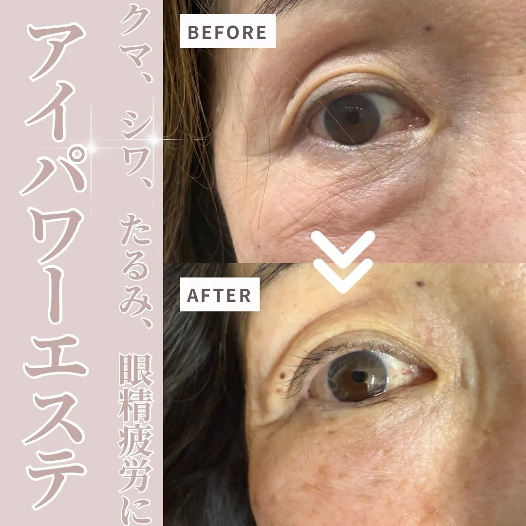 @bijoueyes_masayo___