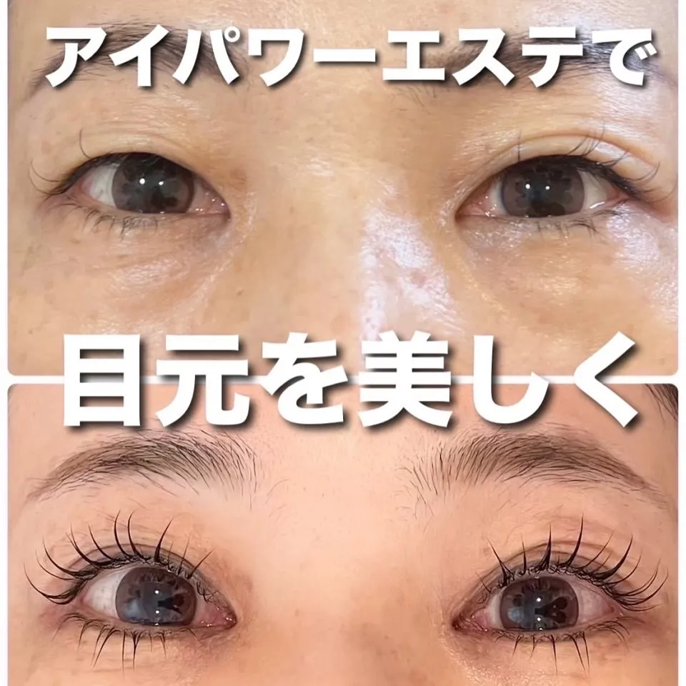 👑神奈川県では当店のみの施術可能👑