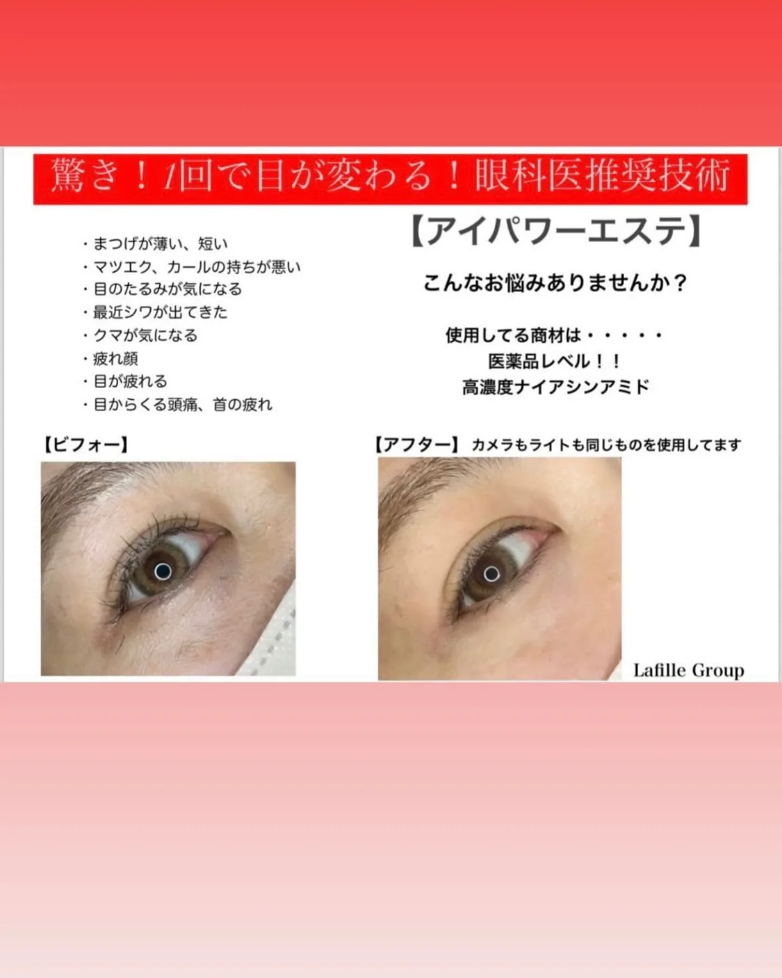 @bijoueyes_masayo___ 