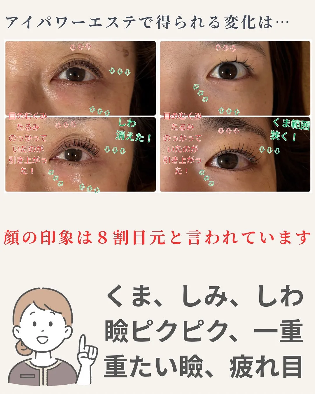 @bijoueyes_masayo___ 