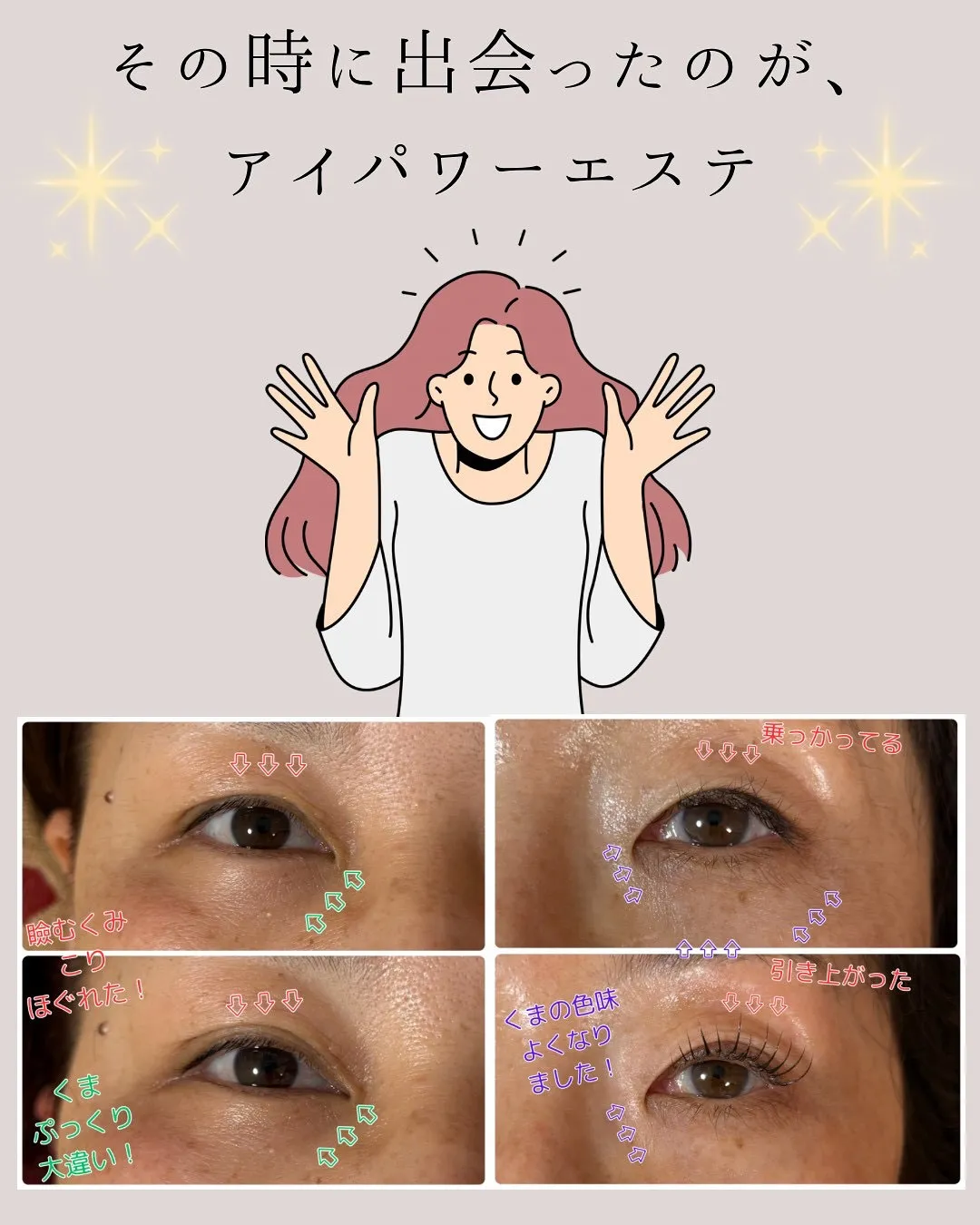 @bijoueyes_masayo___ 