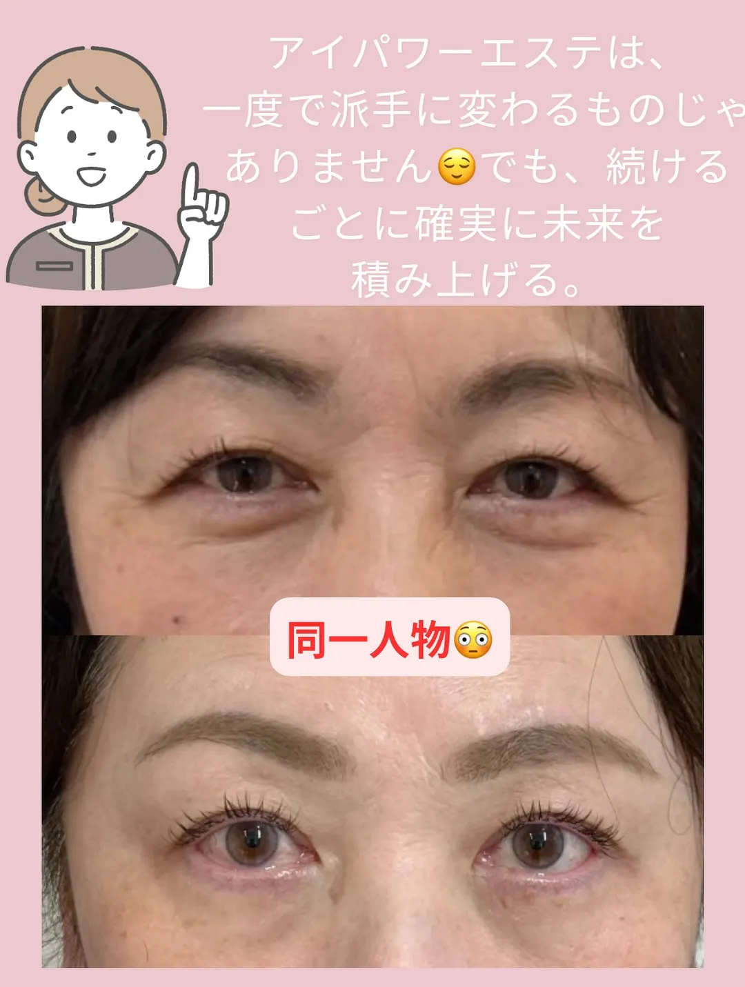 @bijoueyes_masayo___ 