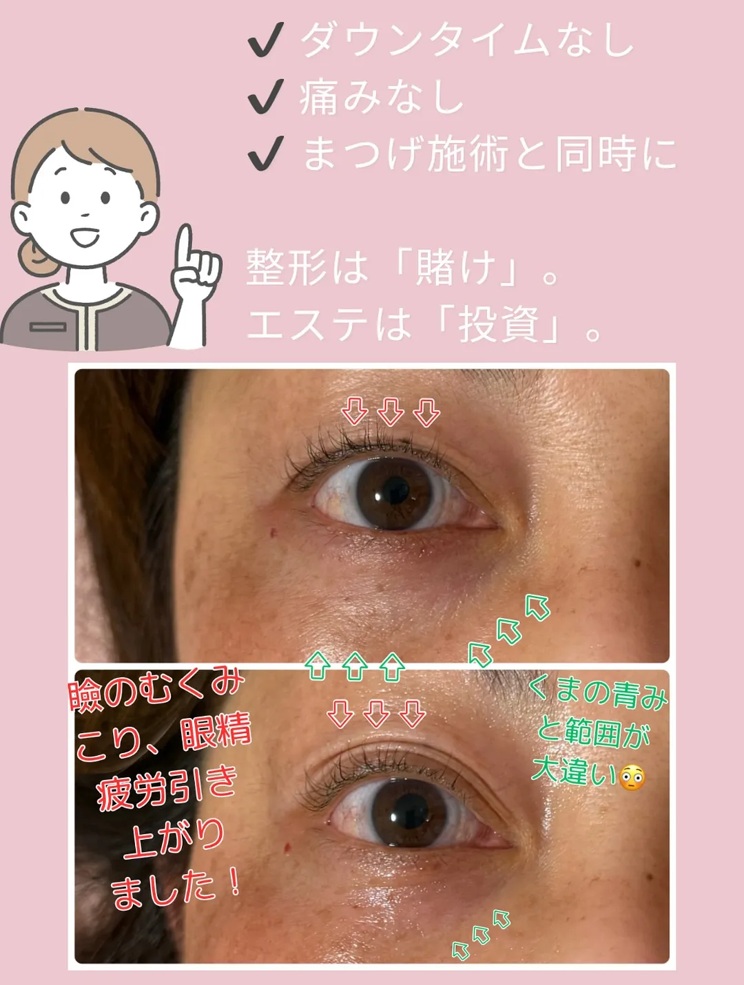 @bijoueyes_masayo___ 