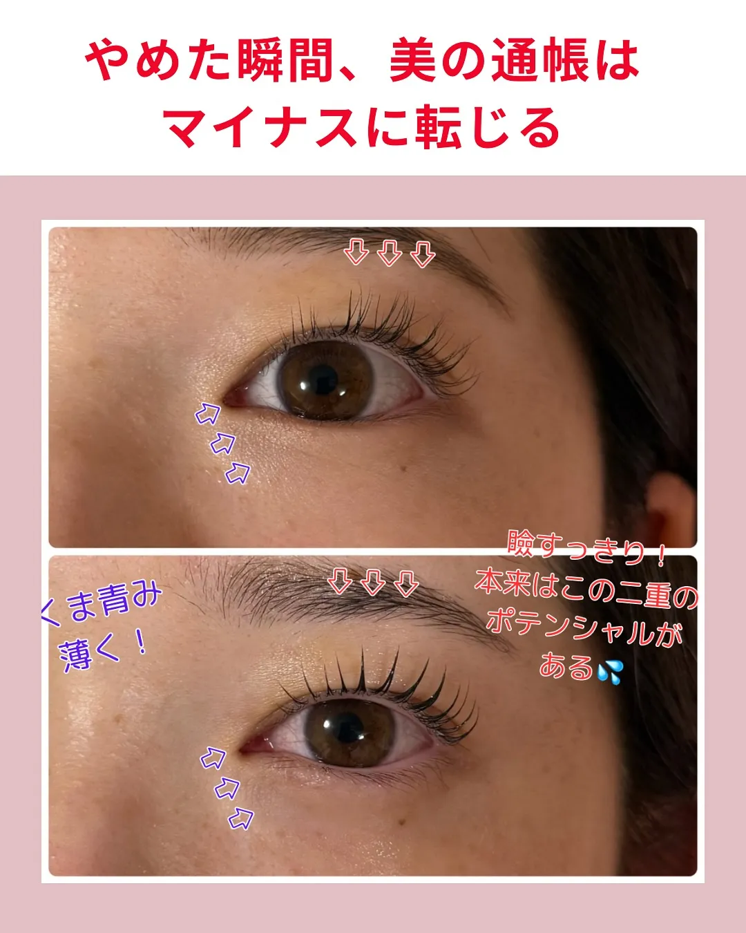 @bijoueyes_masayo___ 10年後、目で年齢...