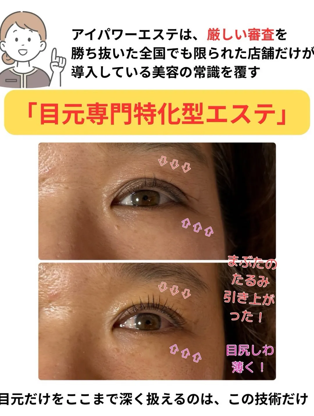 @bijoueyes_masayo___ 目元を変えないまま...