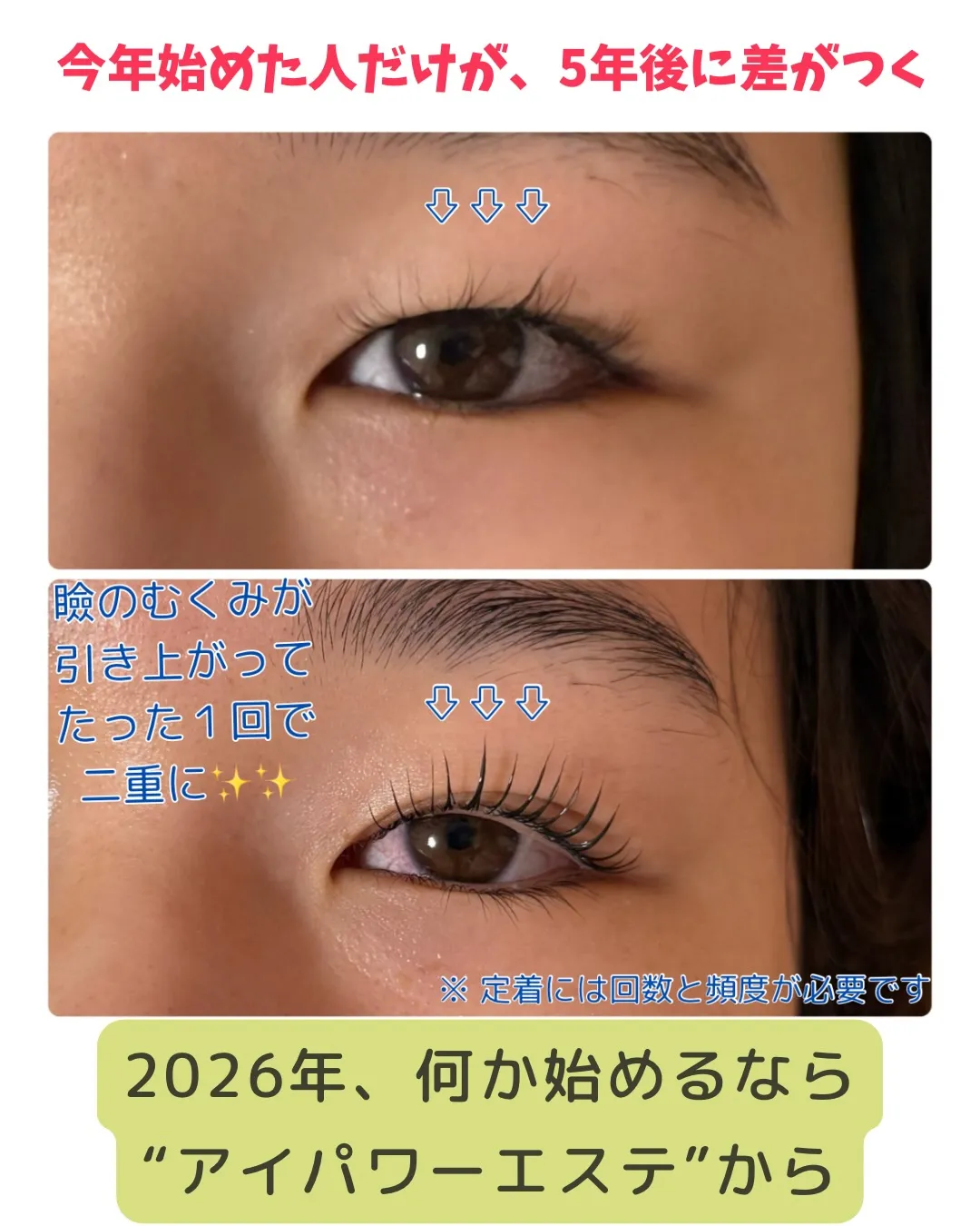 @bijoueyes_masayo___ アイパワーエステ