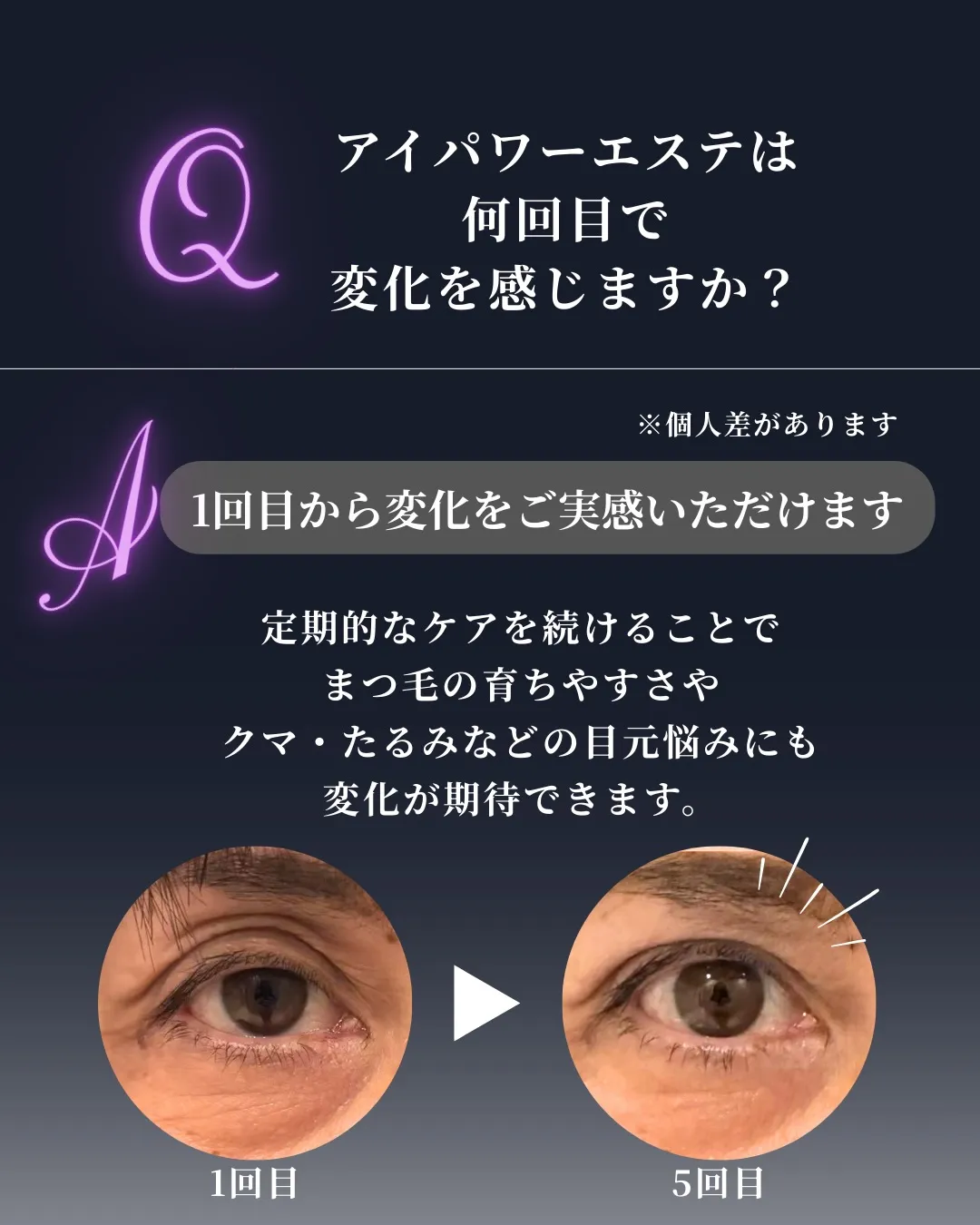 @bijoueyes_masayo___ アイパワーエステと...