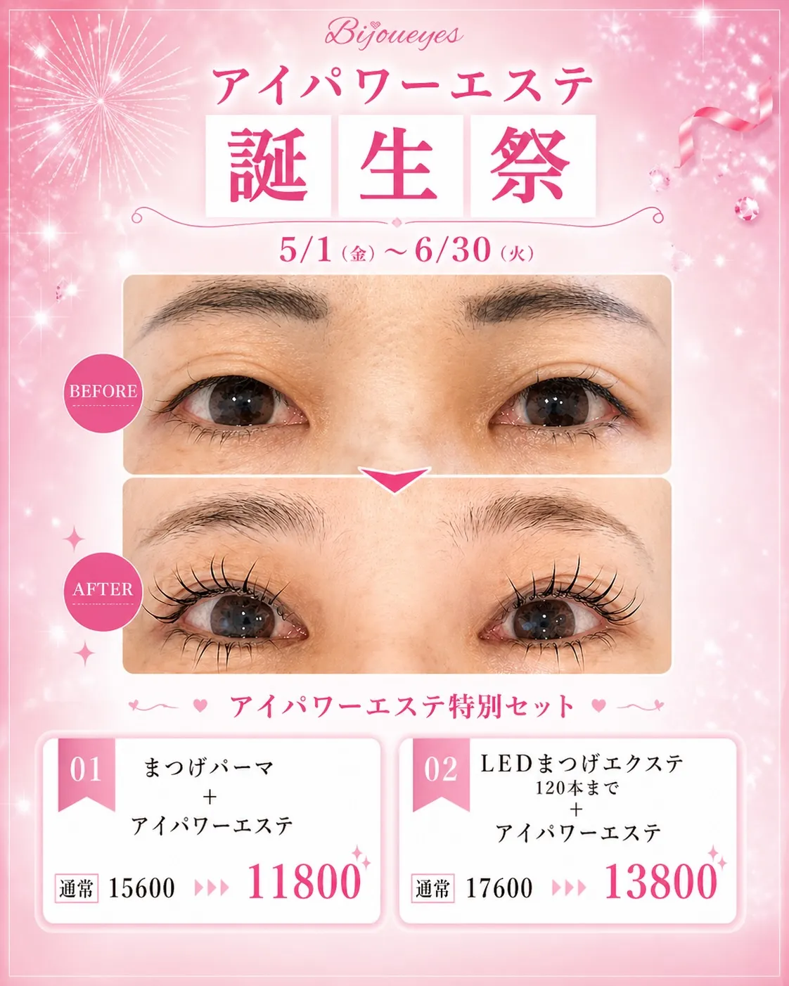 @bijoueyes_masayo___アイパワーエステ誕生...