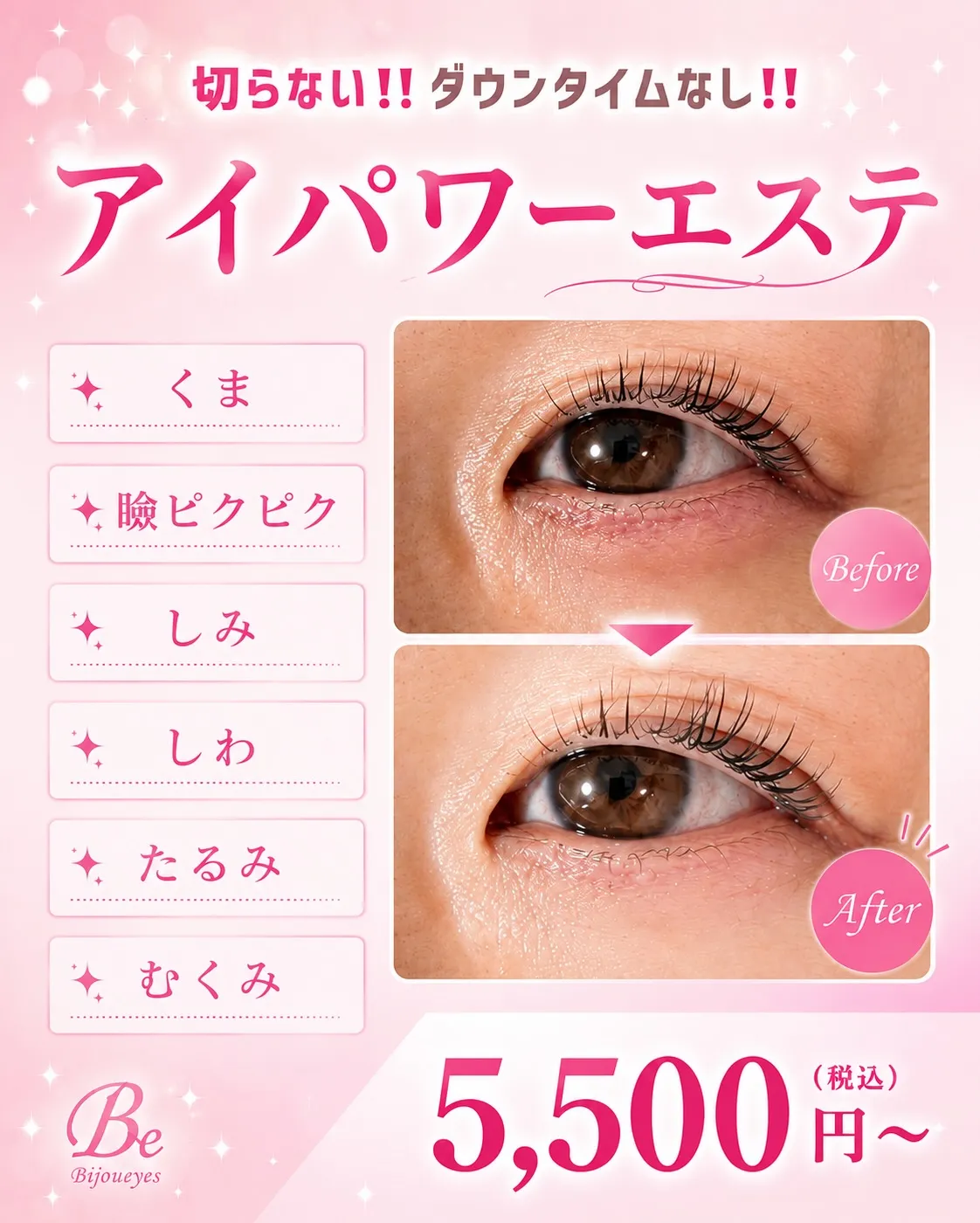 @bijoueyes_masayo___ 切らない！！ダウン...