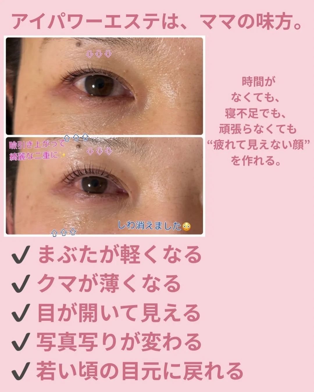 @bijoueyes_masayo___ 切らない！！ダウン...