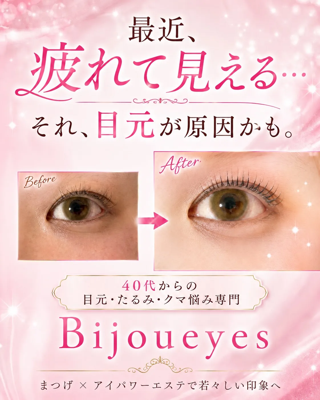 @bijoueyes_masayo___ Bijoueyes...